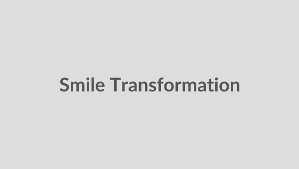 patient before and after veneers